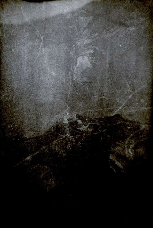 20B